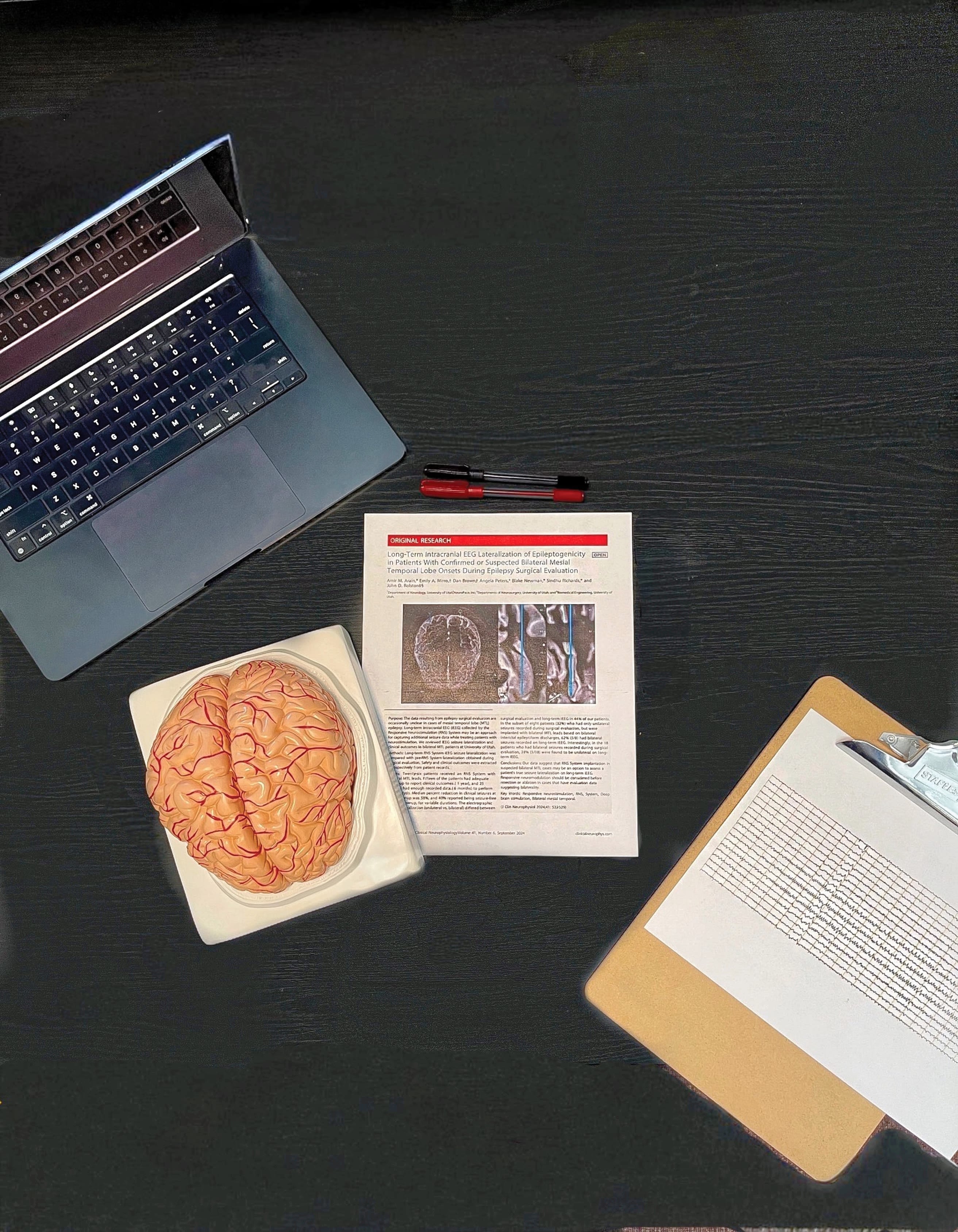 Bird's-eye view of a black wooden desk. A research paper rests in the middle of the desk, next to an open laptop, a plastic model of a brain, some pens, and a clipboard with an EEG scan on it. 